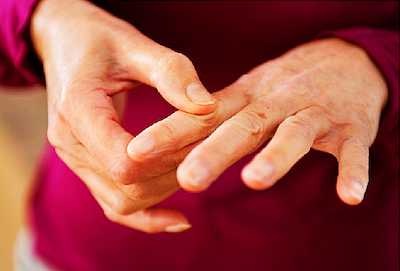 LUPUS-Joint-Pain