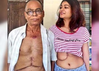 iforher-daughter-liver-donation