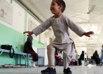 iforher-afghan-kid-prosthetic