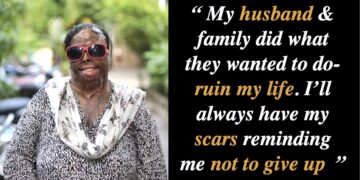 Zakira-Acid-Attack-Survivor-Mother-Inspiring-Story-IForHer