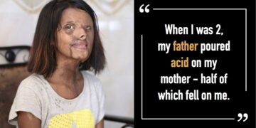 Acid-Attack-Survivor