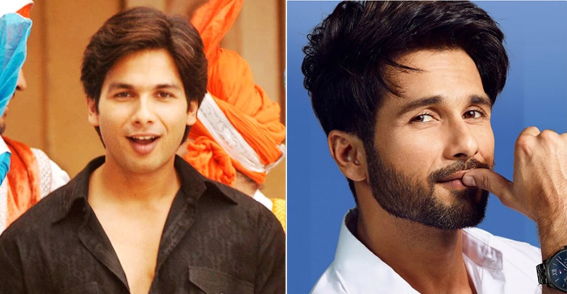 Shahid Kapoor Plastic Surgery