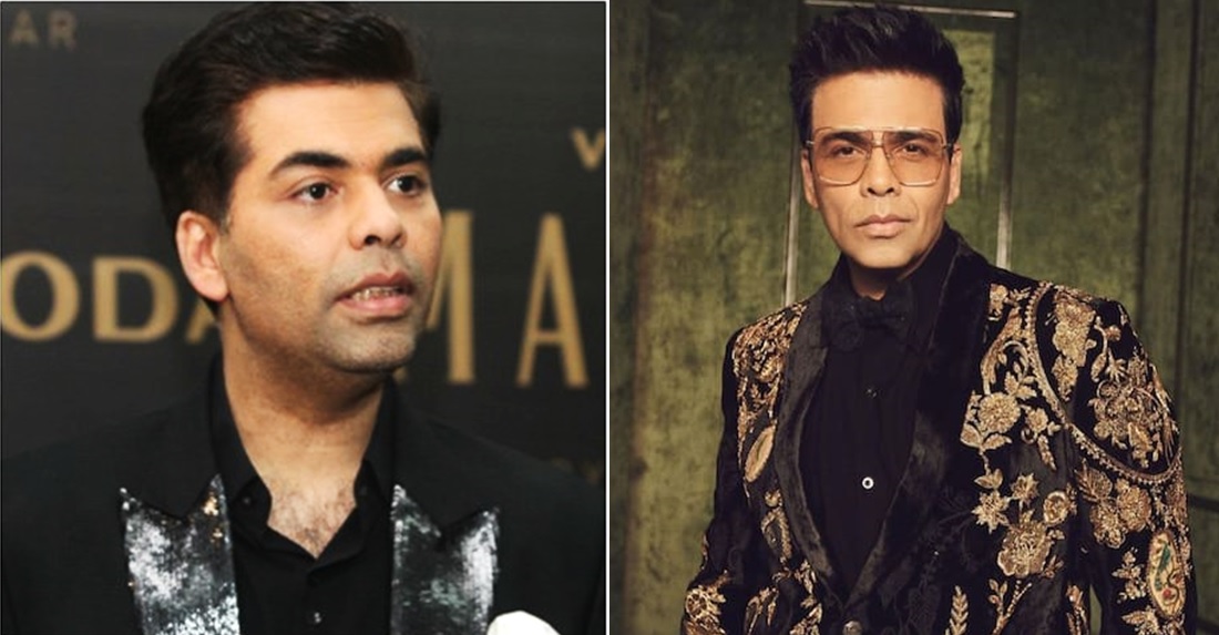 karan johar plastic surgery