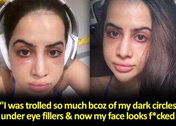 Urfi Javed -eye-fillers